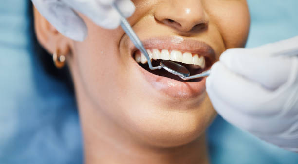 Best Emergency Dentist for Knocked-Out Tooth in Ironton, OH