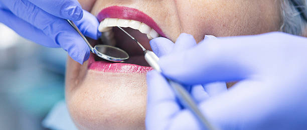 Best Emergency Dental Extractions in Ironton, OH